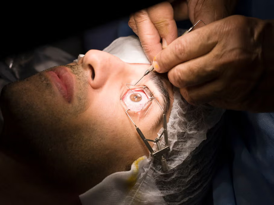 Лазерная Коррекция Зрения (LASIK)